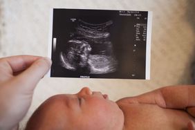 Person holding an ultrasound image over a baby boy