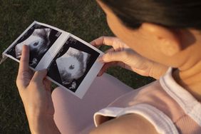 Pregnant woman holding ultrasound photo