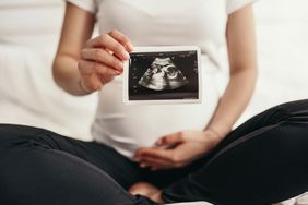 pregnant woman holding an ultrasound photo