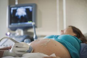 pregnancy ultrasound