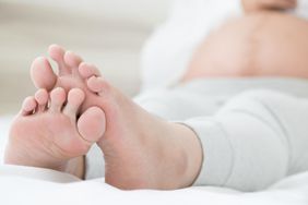 Pregnant Woman Swelling Feet