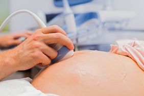 Pregnant woman having fetal ultrasound