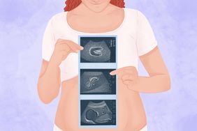 An illustration of a person holding ultrasound picture of a baby girl