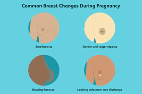 Breast changes during pregnancy