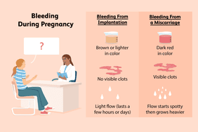 bleeding during pregnancy