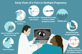 early clues of twin or multiple pregnancy