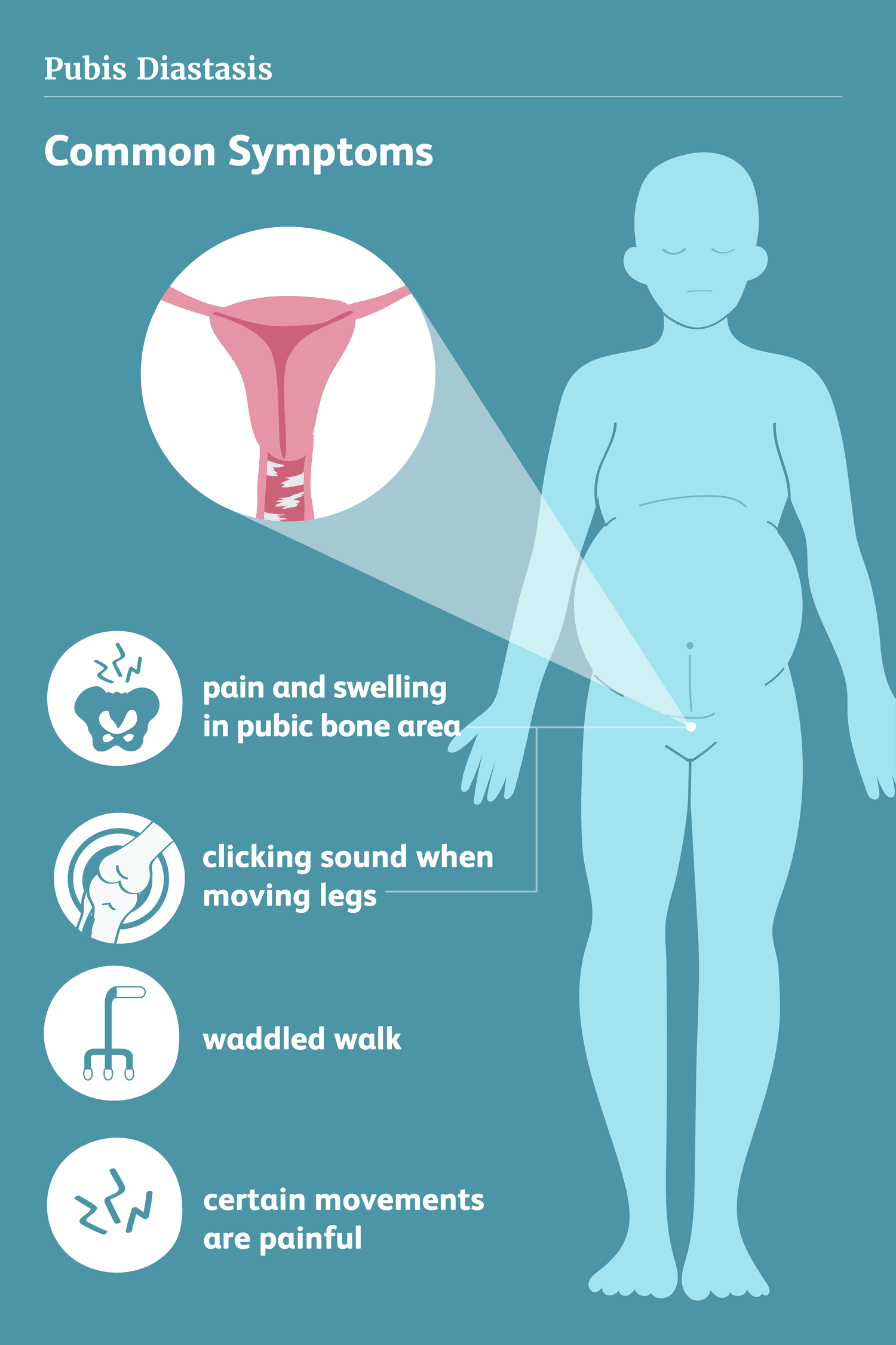 illustration of body highlighting pain and swelling in pubic area