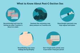 sex after a c-section: what to know