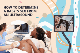 gender ultrasound for determining baby's sex